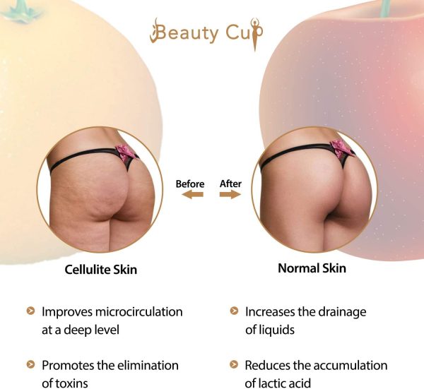 BEAUTY CUP Coppetta Anticellulite in Silicone Coppetta Cellulite Professionale Olio/Vacuum Trattamento Corpo Coppettazione per gamba braccia collo schiena ecc,Nero